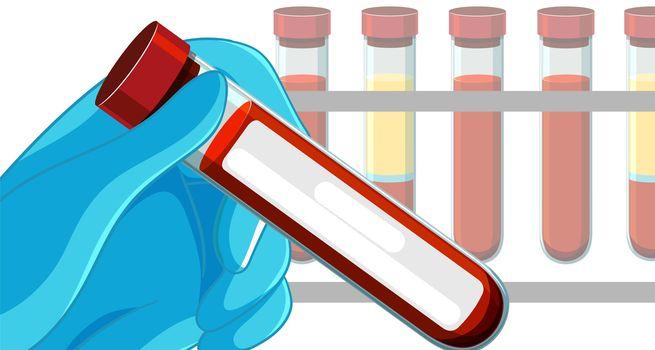 Mdxhealth (NASDAQ: MDXH) Reports Q2 Revenue of USD 26.6Mn, Inks Deal to Acquire Exosome Diagnostics