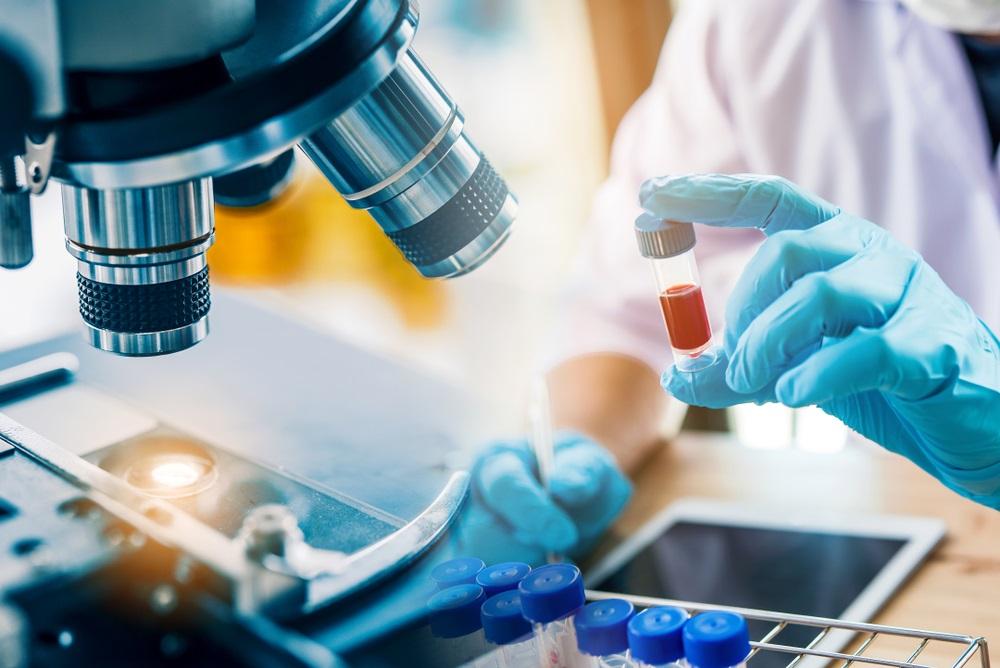 Technical Analysis on One NASDAQ- Listed Pharmaceutical Stock- BTAI
